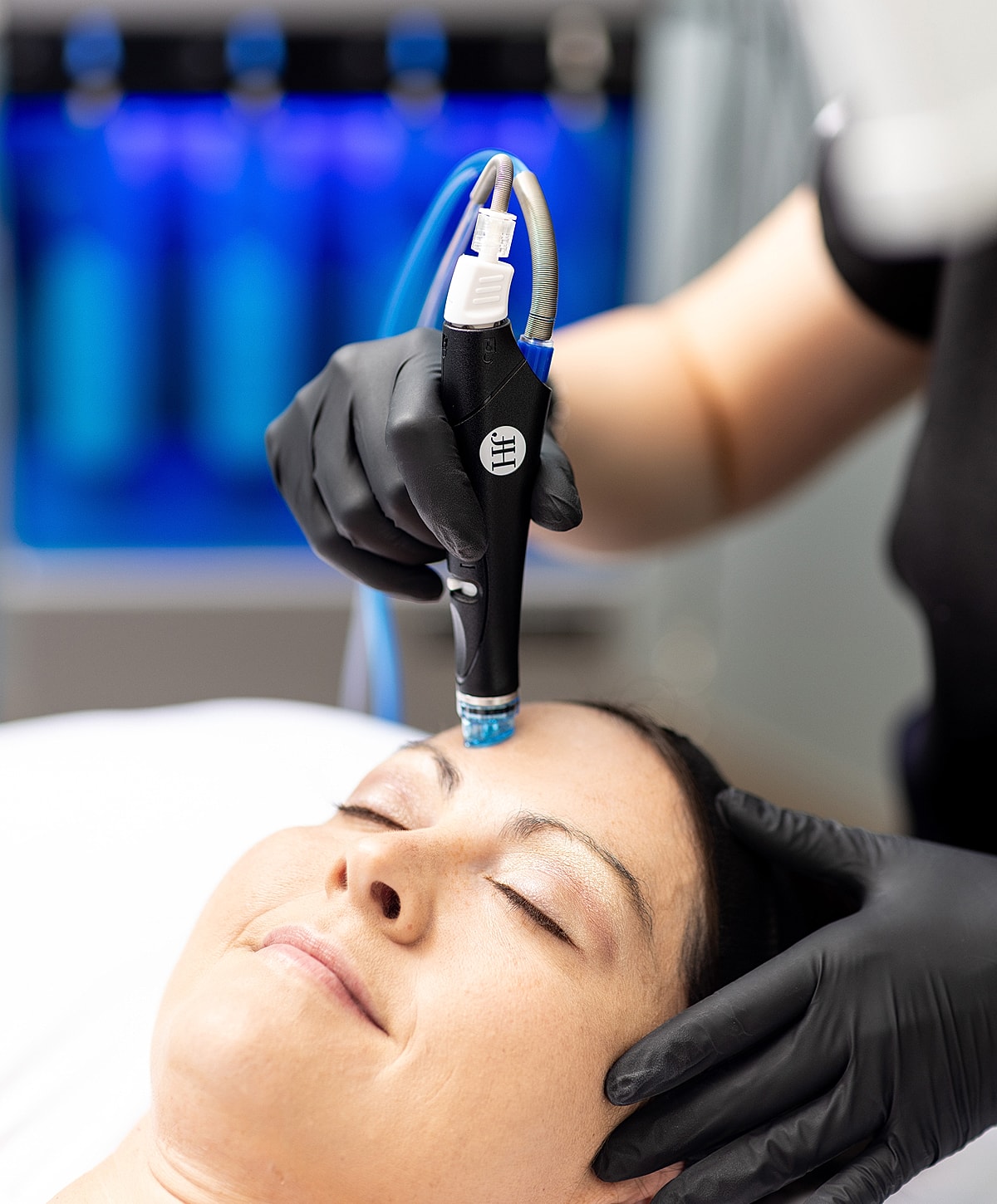 Facial treatment with microneedling device in progress.