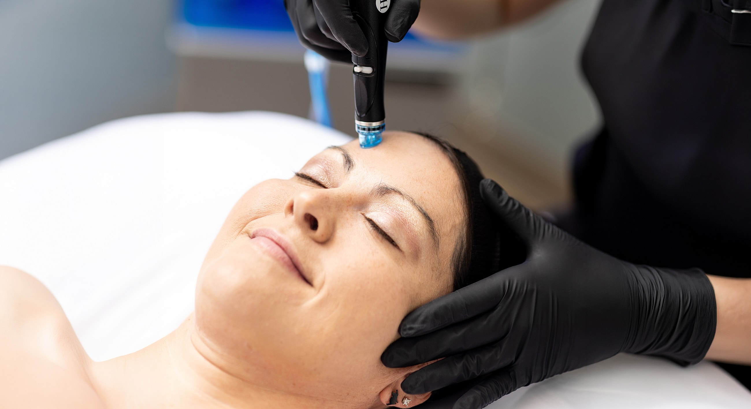 Facial treatment with microdermabrasion on a client.